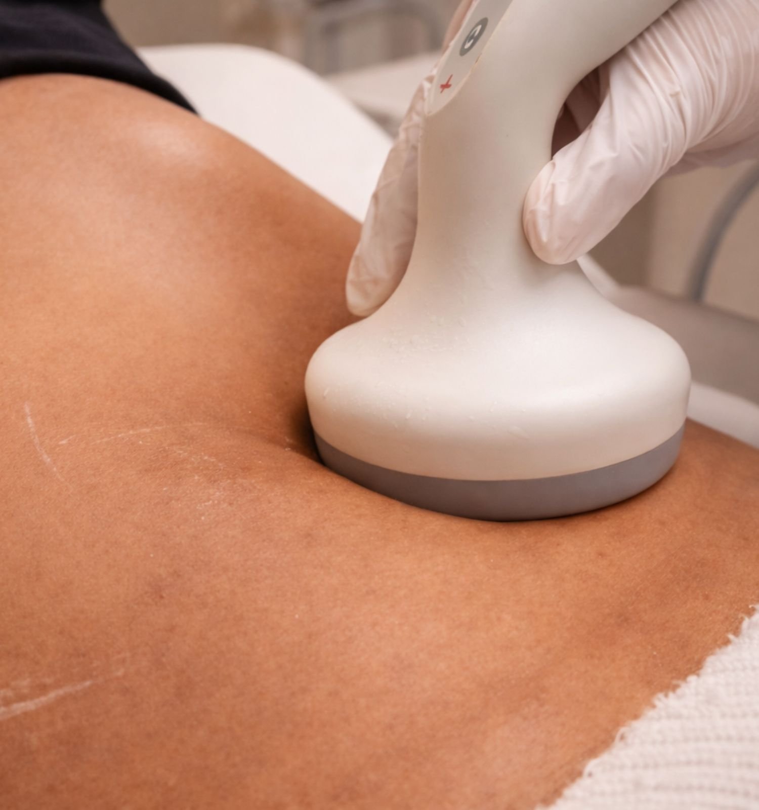 Precision Body Contouring Therapy